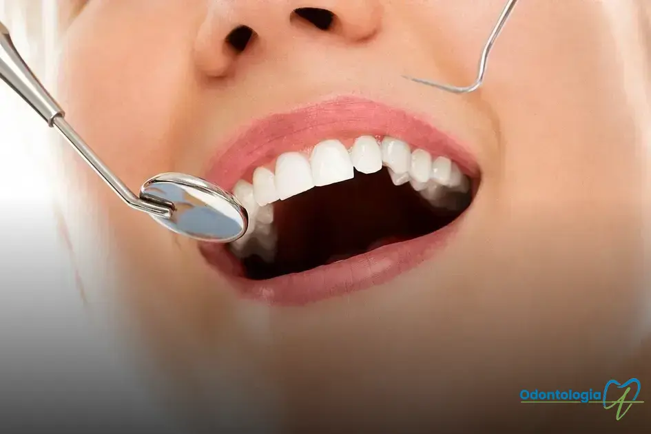 branqueamento dental