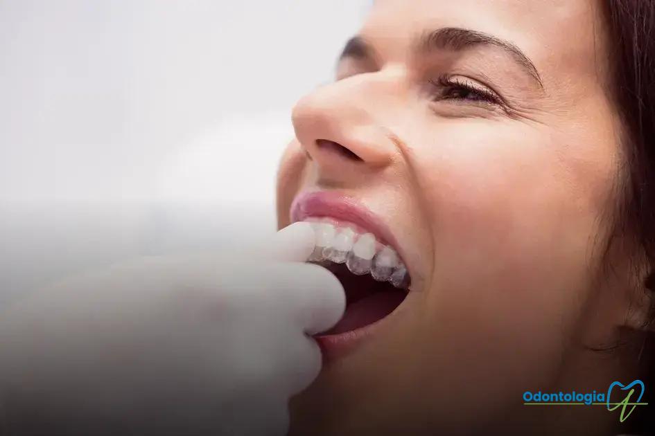 Quando é necessário um tratamento de restauração dental?