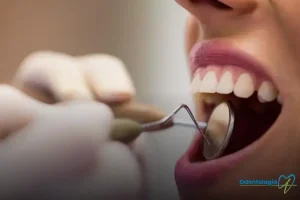 Limpeza dental em Cianorte