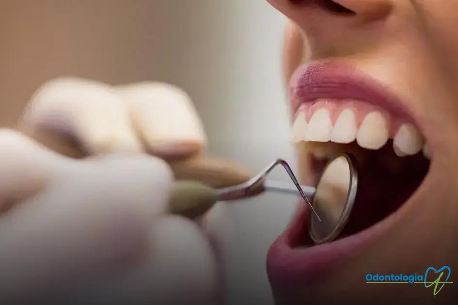 Passo a passo do procedimento de canal dentário