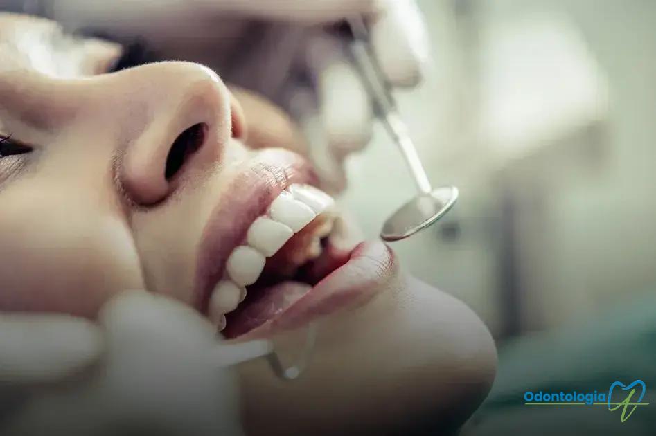 Procedimento de colocação de implantes dentários unitários