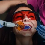 restauração de dente tem garantia