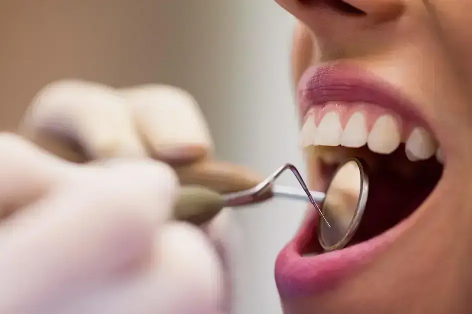 Implantes Dentários em Cianorte: Sorriso Confiante e Saudável