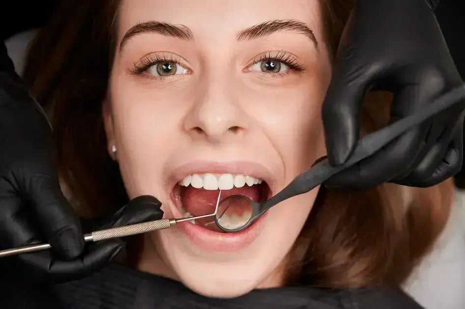 Limpeza de Dente Mal Feita: Como Identificar e Evitar Problemas