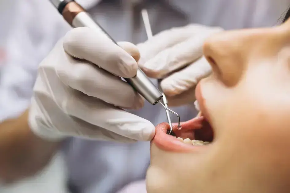 Periodontista em Cianorte: Cuide da Sua Saúde Bucal Agora!