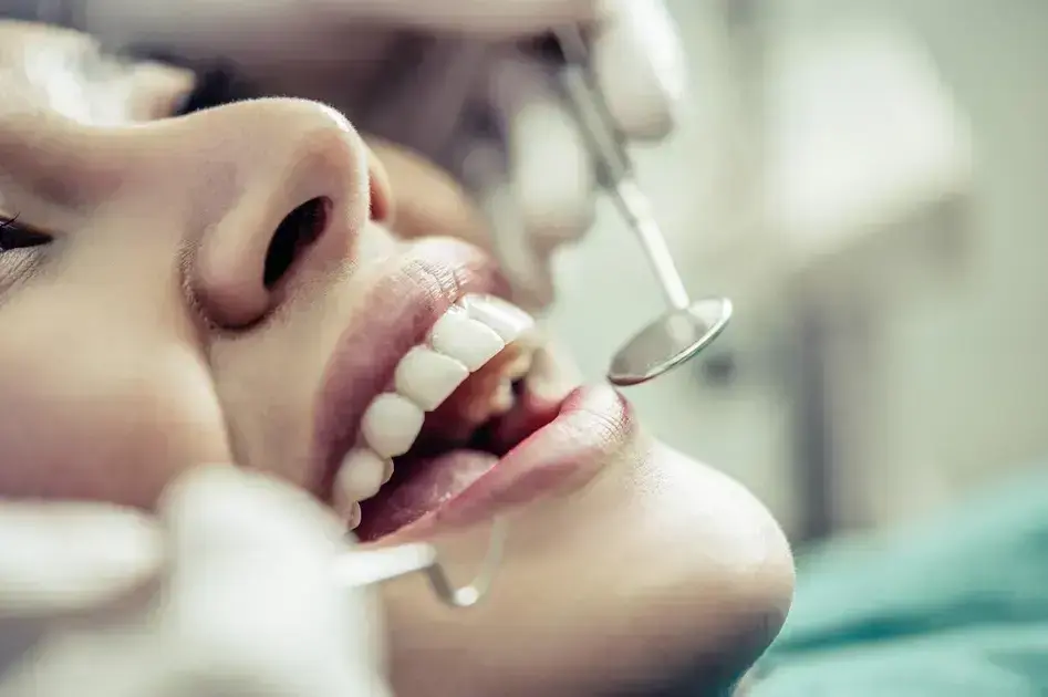 Procedimento de Limpeza Dental em Cianorte: O que Esperar