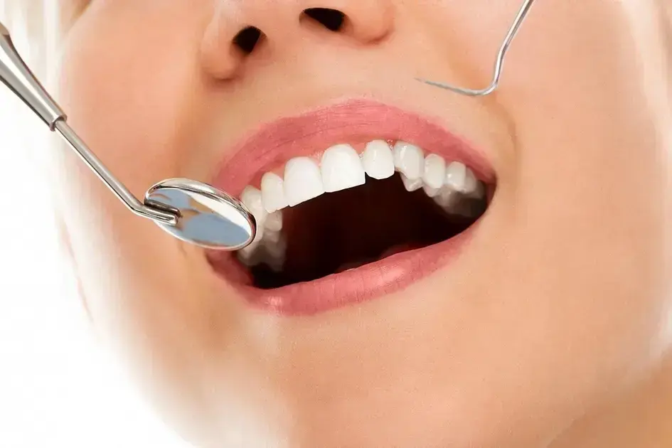 Qual Idade Cai os Dentes de Leite? Saiba Aqui!